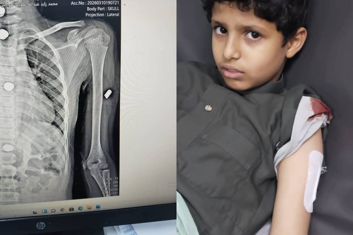 شبوة.. إطلاق نار عشوائي من جنود في مدينة عتق يصيب امرأتين وطفل 