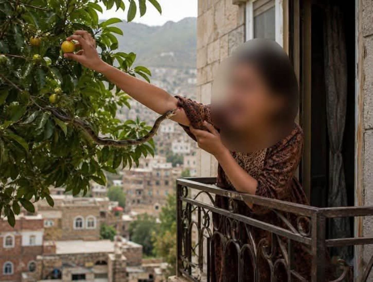 الطفلة أنسام تتعرض للدغات الثعابين 9 مرات خلال شهرين في تعز