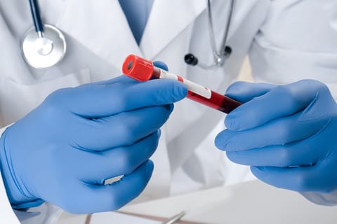 علماء يطوّرون اختبار دم للكشف المبكر عن سرطان البنكرياس بدقة 87 بالمئة 