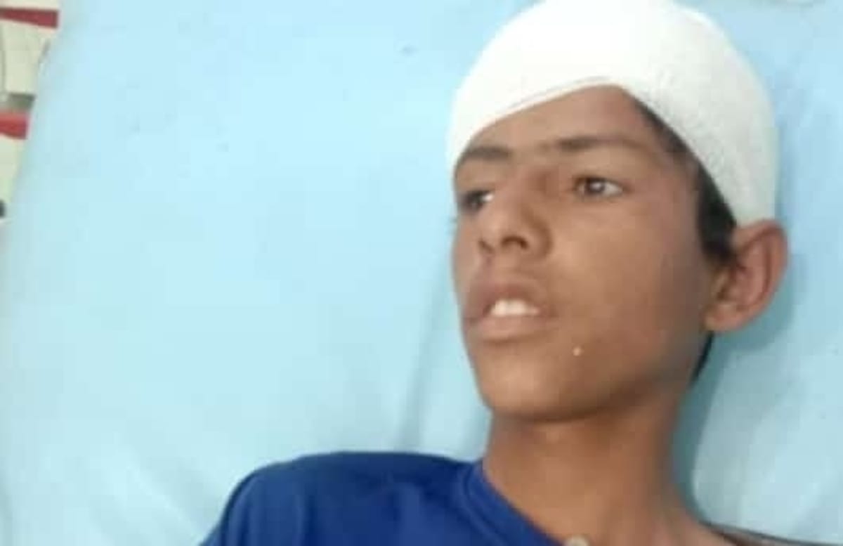 مقتل طفل وإصابة آخر برصاص مسلحين حوثيين في حادثتين منفصلتين