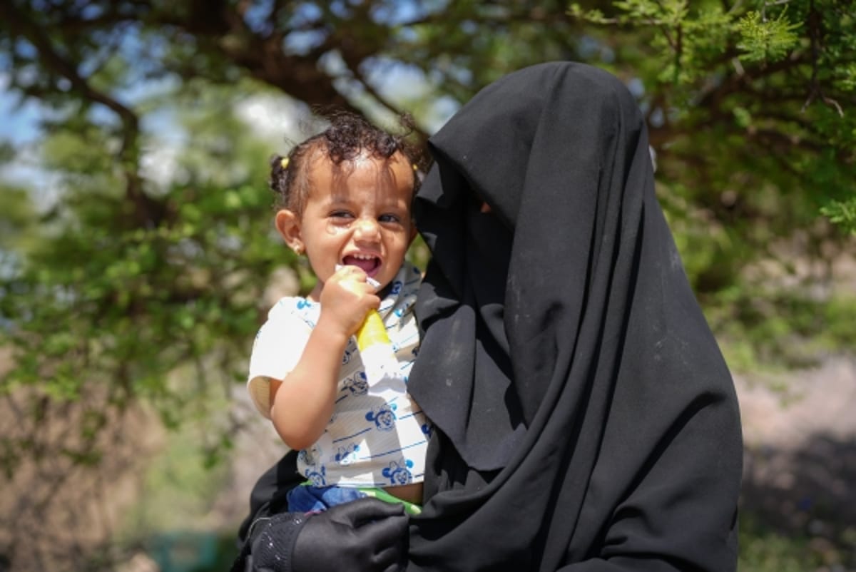 الصحة العالمية: 540 ألف طفل يمني دون الخامسة يعانون من الهزال الشديد