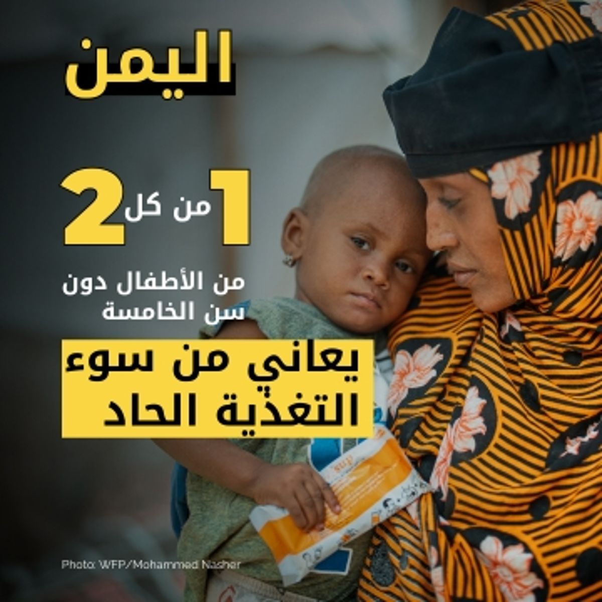 الأمم المتحدة: 55 بالمئة من أطفال اليمن يعانون سوء التغذية المزمن