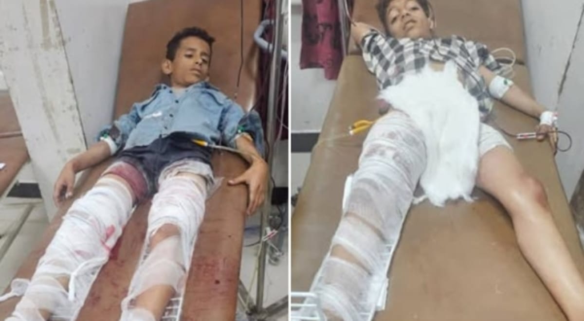 قناص حوثي يصيب طفلين بجروح غربي تعز