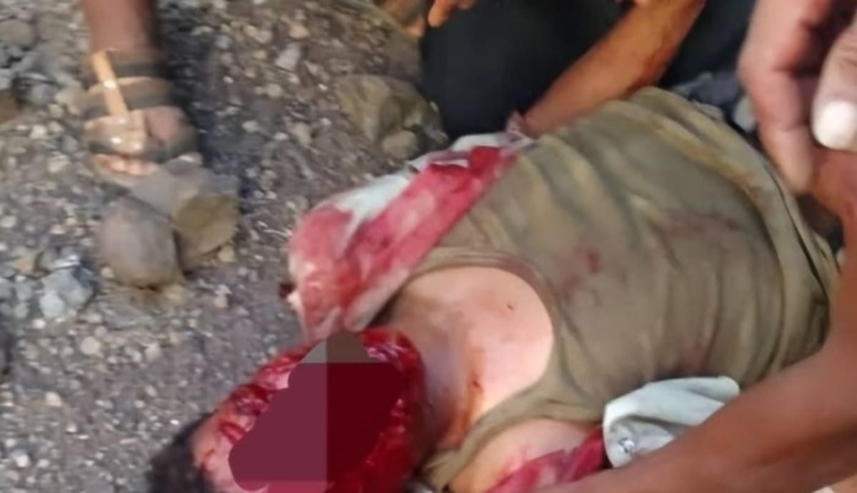 إصابة شاب في تعز بشظايا عبوة ناسفة زرعتها الحوثيون