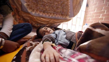 طفلة يمنية تعاني من وباء الكوليرا - أرشيفية