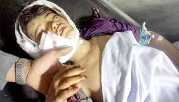 طفل قتل بغارات للتحالف في الجوف
