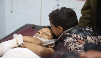 طفل يودع شقيقة الذي قتل بقصف حوثي على تعز