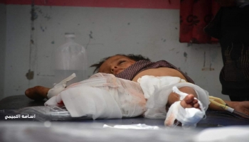 أحد الأطفال الضحايا، صورة: أسامة التميمي