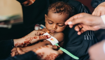 ملايين الأطفال باليمن يعانون سوء التغذية