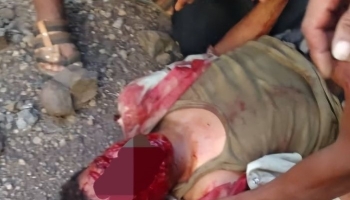 إصابة شاب في تعز بشظايا عبوة ناسفة زرعتها الحوثيون