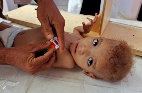 الأمم المتحدة: تمويل 25 بالمئة فقط من خطة الاستجابة الإنسانية في اليمن