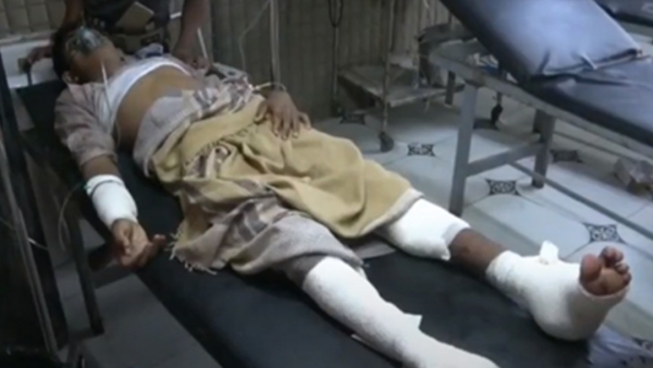 مقتل مدني وإصابة 5 جراء قصف حوثي استهدف مطعماً بالدريهمي