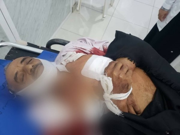 مقتل مواطن في تعز برصاص قناص حوثي
