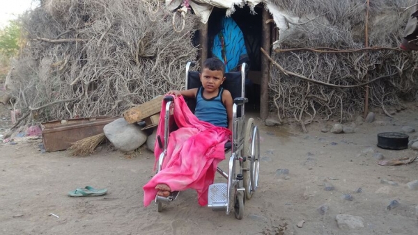 عبد الله اليمني البالغ من العمر سبع سنوات أصيب في انفجار لغم أرضي في محافظة تعز