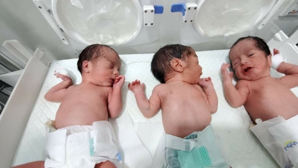 ولادة نادرة لثلاثة أطفال "توائم" في هيئة مستشفى مارب العام