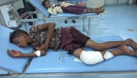 إصابة طفلين برصاص حوثي واختطاف مزارعين في "الحشاء" بالضالع