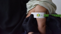 "يونيسف" تعتزم تقديم خدمات صحية لأكثر من 8 آلاف أسرة يمنية