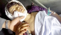 مقتل وجرح 59 مدنيا بغارات للتحالف العربي في الجوف خلال 3 أسابيع