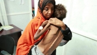 دراسة تحذر من اتساع المجاعة في اليمن بسبب استمرار الحرب والفساد