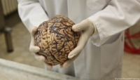 أطباء يكشفون ما يحدث لدماغ الإنسان في لحظة الموت